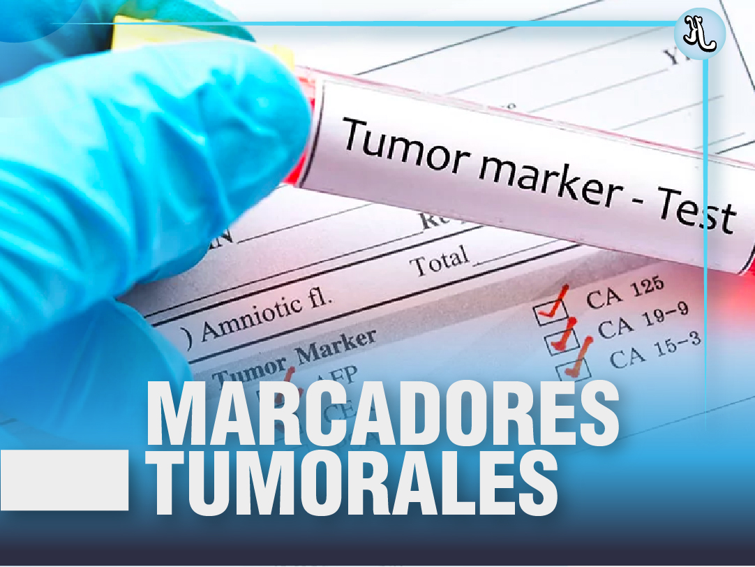 Marcadores Tumorales